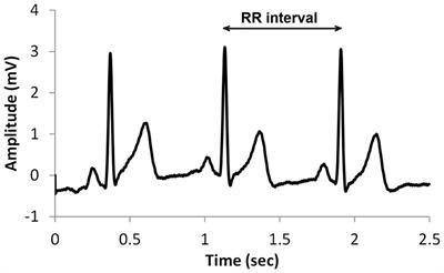 A Review and Comparison of the State-of-the-Art Techniques for Atrial Fibrillation Detection and Skin Hydration